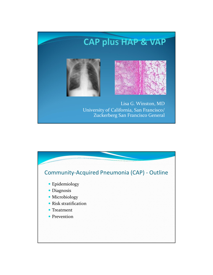 community acquired pneumonia cap outline
