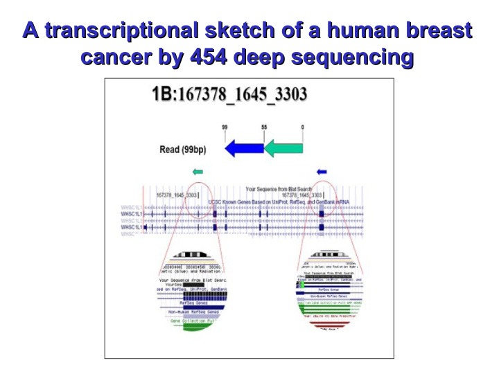 a transcriptional sketch of a human breast a