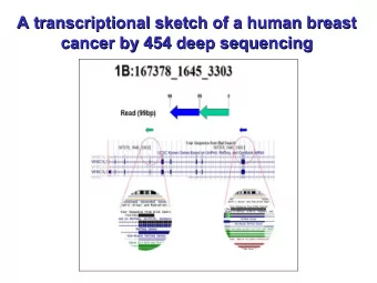 A transcriptional sketch of a human breast  A transcriptional sketch of a human breast  cancer by