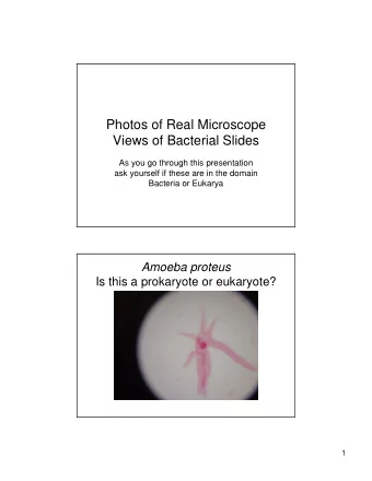 Photos of Real Microscope  Views of Bacterial Slides  As you go through this presentation  ask