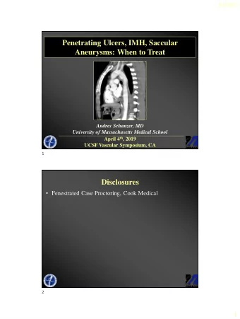 Aneurysms: When to Treat  Andres Schanzer, MD  University of Massachusetts Medical School April 4