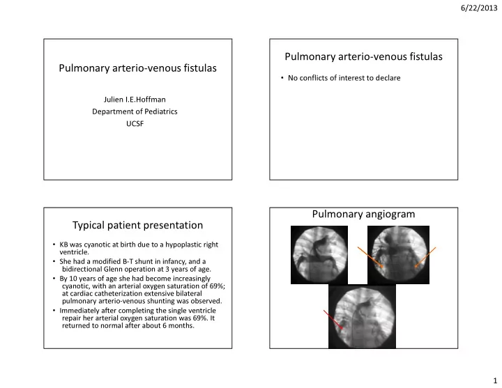 pulmonary arterio venous fistulas pulmonary arterio