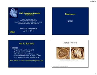Aortic Stenosis  Aortic Stenosis   Etiology   Congenital (bicuspid, unicuspid)   Rheumatic