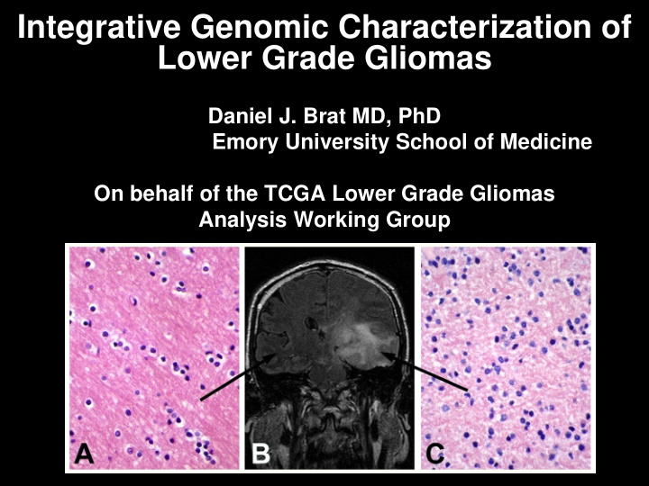 integrative genomic characterization of lower grade