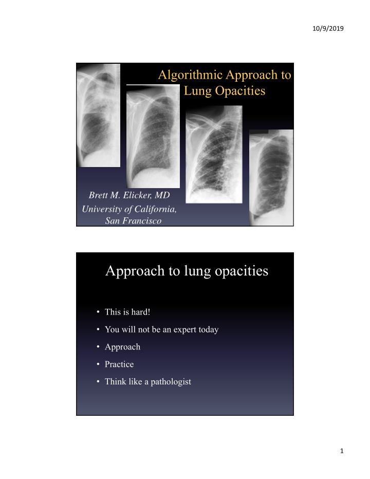 approach to lung opacities
