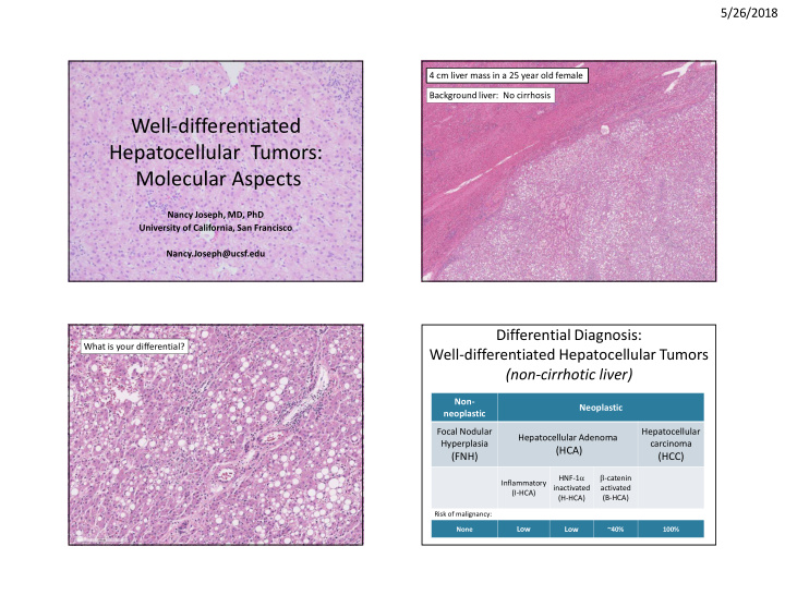 well differentiated hepatocellular tumors molecular