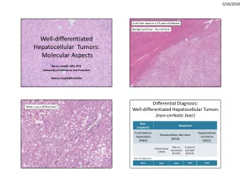 Well-differentiated  Hepatocellular  Tumors:  Molecular Aspects  Nancy Joseph, MD, PhD  University