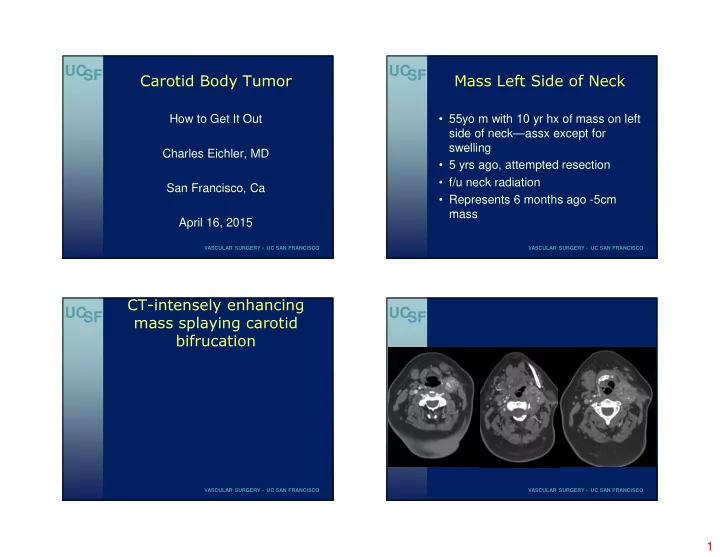 uc uc sf sf carotid body tumor mass left side of neck