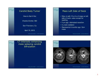 UC  UC  SF  SF  Carotid Body Tumor  Mass Left Side of Neck  How to Get It Out   55yo m with 10