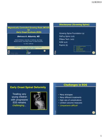 Challenges in EOS  Early Onset Spinal Deformity  Treating very  Many etiologies  young children
