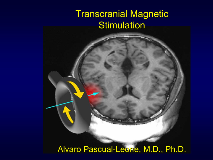transcranial magnetic transcranial magnetic stimulation