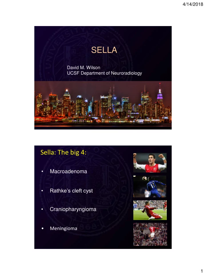 sella