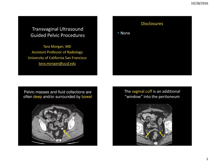 transvaginal ultrasound