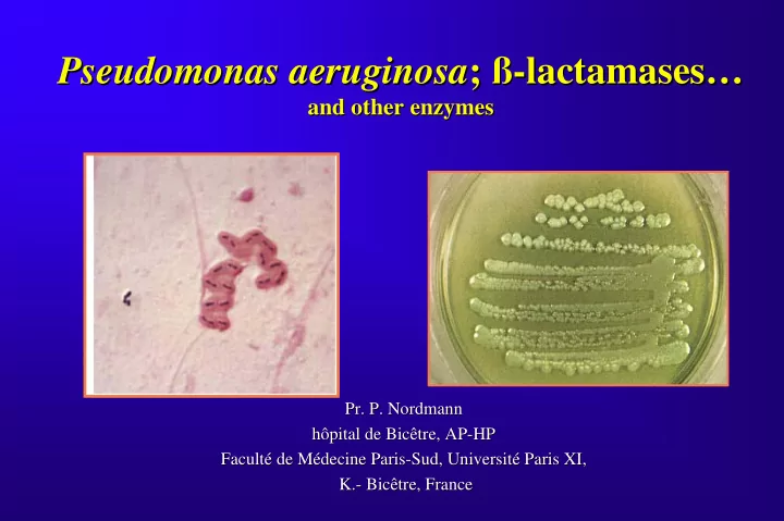 pseudomonas aeruginosa lactamases lactamases pseudomonas