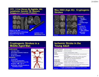 Cryptogenic Strokes in a  Ischemic Stroke in the  Middle-Aged Man  Young Adult  unknowns  the usual