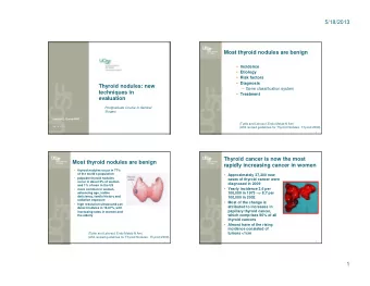 5/18/2013  Most thyroid nodules are benign  Incidence  Etiology  Risk factors