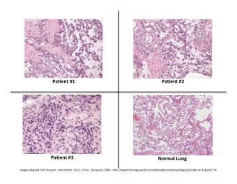 Pa#ent  #1      Pa#ent  #2    Pa#ent  #3     Normal  Lung  Images