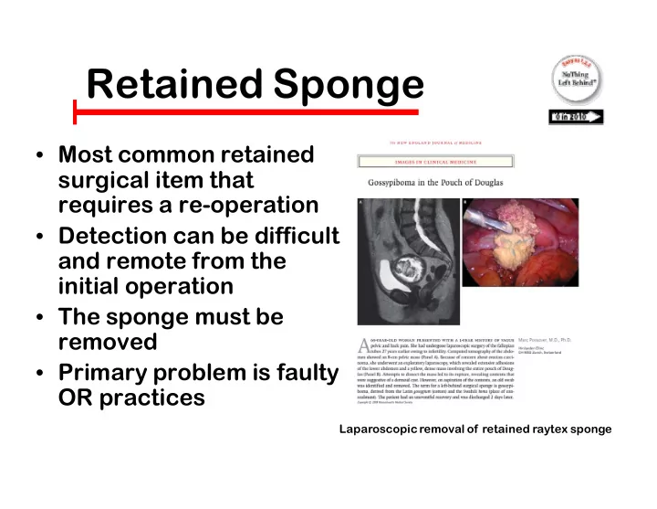ret retaine ined sponge sponge
