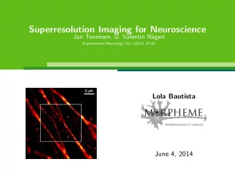 Superresolution Imaging for Neuroscience  Jan Tonnesen, U. Valentin N  agerl  Experimental