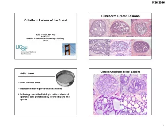 Cribriform Breast Lesions  Cribriform Lesions of the Breast  Yunn-Yi Chen, MD, PhD  Professor