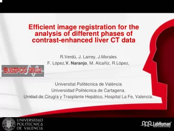 Efficient image registration for the  analysis of different phases of  contrast-enhanced liver CT