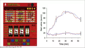 Joutsa et al. (2012). NeuroImage: 60: 19921999  Joutsa et al. (2012). NeuroImage: 60: