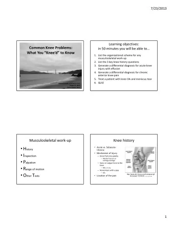 Significance of acute effusion  Knee exam case #1: Inspection  Intra  articular derangement