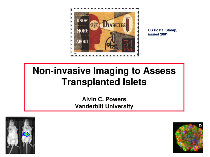 non invasive imaging to assess transplanted islets