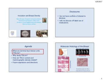 Agenda  Mammographic Density   What are terminal duct lobular units  (TDLUs)?   Why study