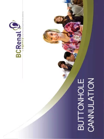 BUTTONHOLE  CANNULATION  What is a Buttonhole?  Technique in which an AV fistula is cannulated in