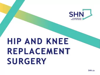 HIP AND KNEE  REPLACEMENT  SURGERY  SHN.ca  AGENDA  1.  Exercise before surgery  2.  Planning For