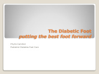 the diabetic foot putting the best foot forward