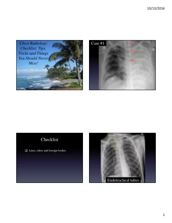 Checklist  Lines, tubes and foreign bodies  Endotracheal tubes  1  10/13/2016  Airway  landmarks