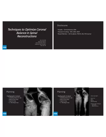 Techniques to Optimize Coronal  Royalty  Zimmerbiomet, K2M  Research Funding  NIH,