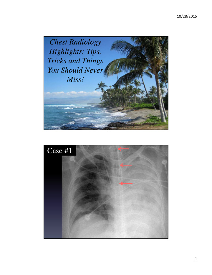 chest radiology highlights tips tricks and things you