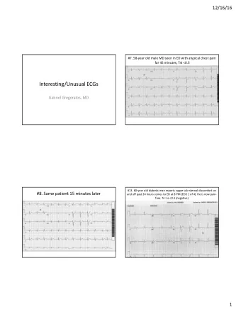 Interesting/Unusual ECGs  Gabriel Gregoratos, MD  #13. 60-year old diabetic man reports vague
