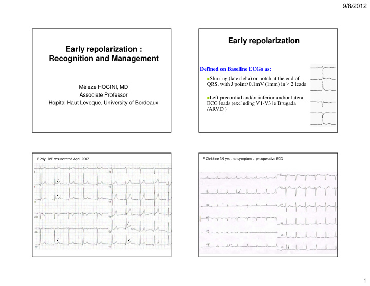 early repolarization early repolarization recognition and