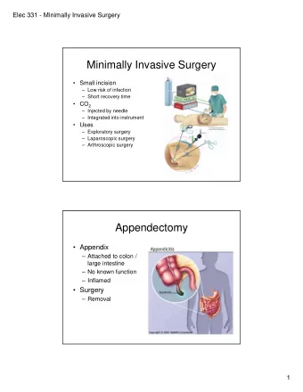 Minimally Invasive Surgery   Small incision   Low risk of infection   Short recovery time