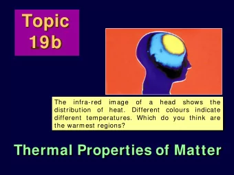 Topic  19b  The  infra-red  image  of  a  head  shows  the  distribution of heat. Different colours