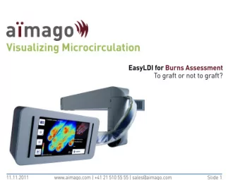LDI Average vs. Body parts  125.00