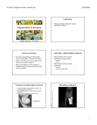 Last time   Fitting an arbitrary shape with active  deformable contours  Segmentation