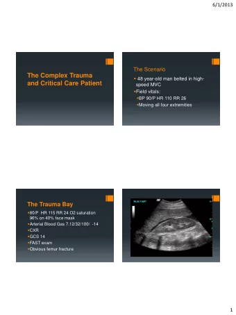 The Complex Trauma  48 year-old man belted in high-  and Critical Care Patient  speed MVC