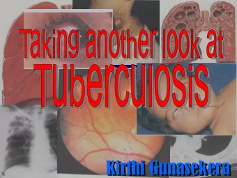 Kirthi Gunasekera  RATE PER 100,000 POPULATION  10  20  30  40  50  60  0  1984  INCIDENCE  AND