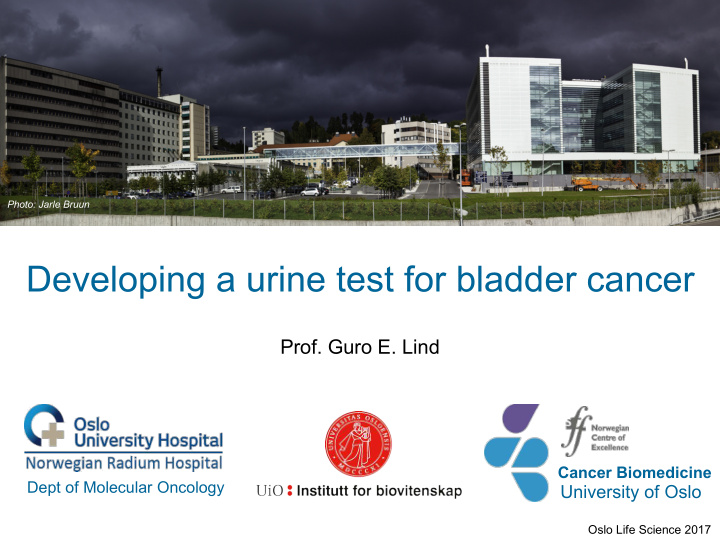 developing a urine test for bladder cancer