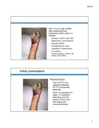 Initial presentation  Physical Exam  Vasc: DP, PT non-  palpable bilaterally.  DP, PT monophasic