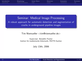 Seminar: Medical Image Processing  A robust approach for automatic detection and segmentation of