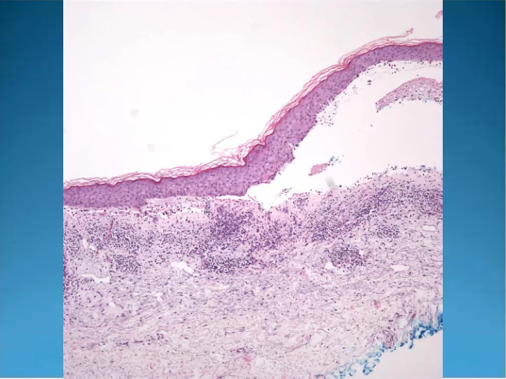 bullous pemphigoid pearls