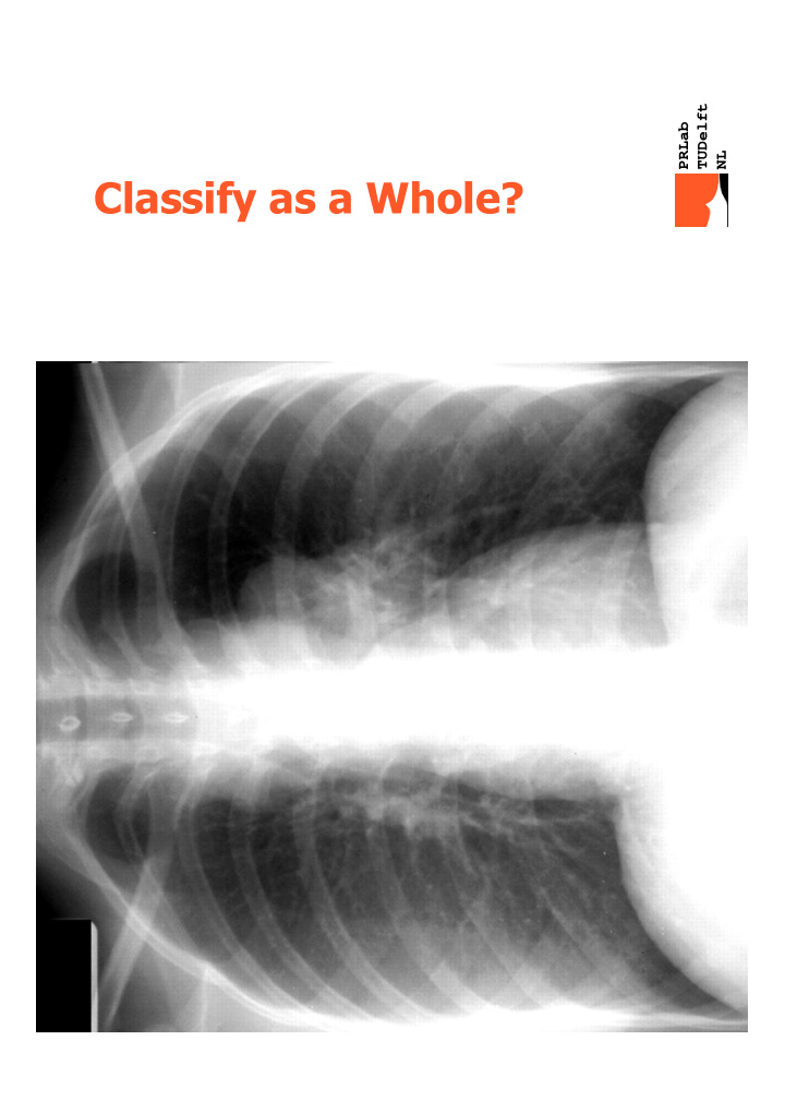 classify as a whole multiple instance learning