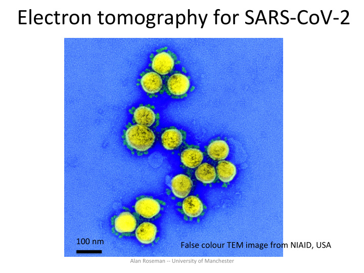 electron tomography for sars cov 2
