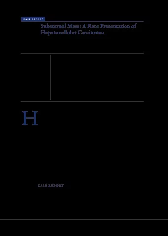H  epatocellular carcinoma (HCC) is the  review of systems was positive for one week of  fjfuh most